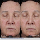 ELASTIDERM® LIFT UP & SCULPT FACIAL MOISTURIZER