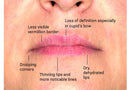 Youthfull Lip Replenisher