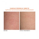 Alpha Beta® Exfoliating Body Treatment 8 Pk