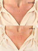 Decollete, Breast, & Butt Occlusion Patch™