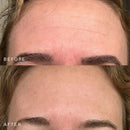 SILICONEFUSION™ Forehead Patch