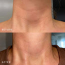 SILICONEFUSION™ Neck Patch