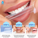 Pursonic Complete Smile Whitening Bundle – LED Whitening Kit + Whitening Pens + Professional Whitening Strips