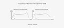 final D8000 Planar Magnetic Headphone