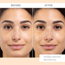 Skin Remedy Barrier-Boosting Sheet Mask