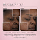 Pore Purifying Gel Cleanser