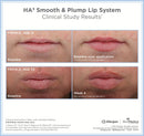 HA5 Smooth and Plump Lip System