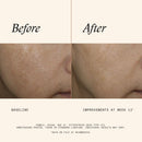Even & Correct Advanced Brightening Treatment