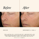 Even & Correct Brightening Treatment Pads