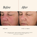 Retinol Complex 0.25