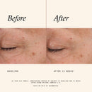 Retinol Complex 1.0