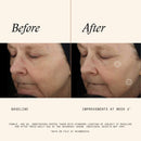 TNS Advanced+ Serum