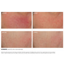 Glycolic 10 Renew Overnight