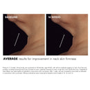 Tripeptide-R Neck Repair
