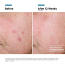 Advanced RGN-6 Regenerative Cream
