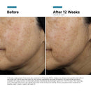 A.G.E. Interrupter Ultra Lifting Serum