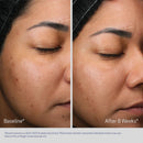 Retinol + PHA Refining Night Cream