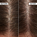 Flaky Scalp Calming Toner