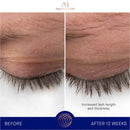 The Eyebrow and Lash Enhancing Serum