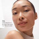 Blanc Peony Face Cream for Dark Spots