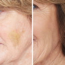 Corrective Colors