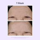 Dream Night Serum with Bio-Retinol