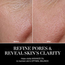 The Balancing Treatment Lotion