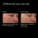 Retinol Treatment for Sensitive Skin