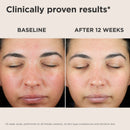 UV Skin Recovery Broad Spectrum SPF 50