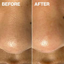 Dermapore+ Blush