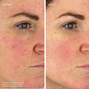 Youth-Boost Peptide Serum