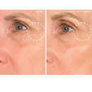 Super EyeLift