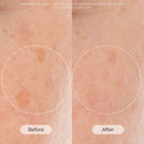Skin Cycling Program