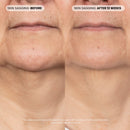 P46 Peptide + HA Plumping Serum