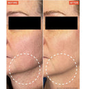 DermaReverse