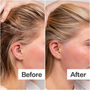 4% Niacinamide Oily Scalp Serum