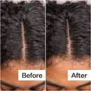Daily Hydro Scalp Serum with Hyaluronic Acid for Dry Scalp