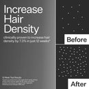 3% Stem Cell Peptide H3-Grow+ Complex Scalp Treatment