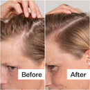 Salicylic Acid Scalp Exfoliator