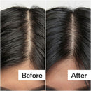 Salicylic Acid Scalp Exfoliator