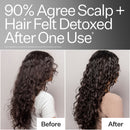Clarifying Hard Water Scalp Treatment For Scalp + Hair Build-Up