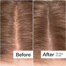 Microbiome Cooling Scalp Serum