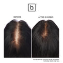 Ultima 12 Hair Growth LaserComb