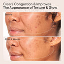 Clarifying Facial Oil with Retinol and Pink Algae