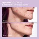 2% BHA Pore Perfecting Liquid Exfoliator for Brighter and Clearer Skin