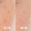 Exfoliation Night Resurfacing and Brightening Serum