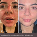 Hidden Agenda Pre and Post Injection Care Serum