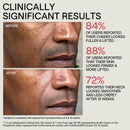 Instafacial Infusion Biomimetic Microcollagen Matrix