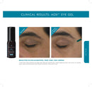 Aox+ Eye Gel