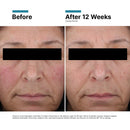 Redness Neutralizer